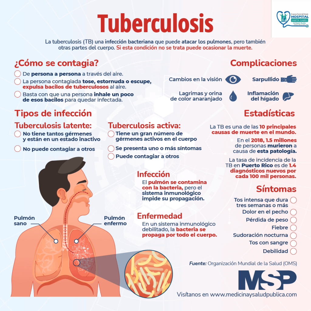 tuberculosis